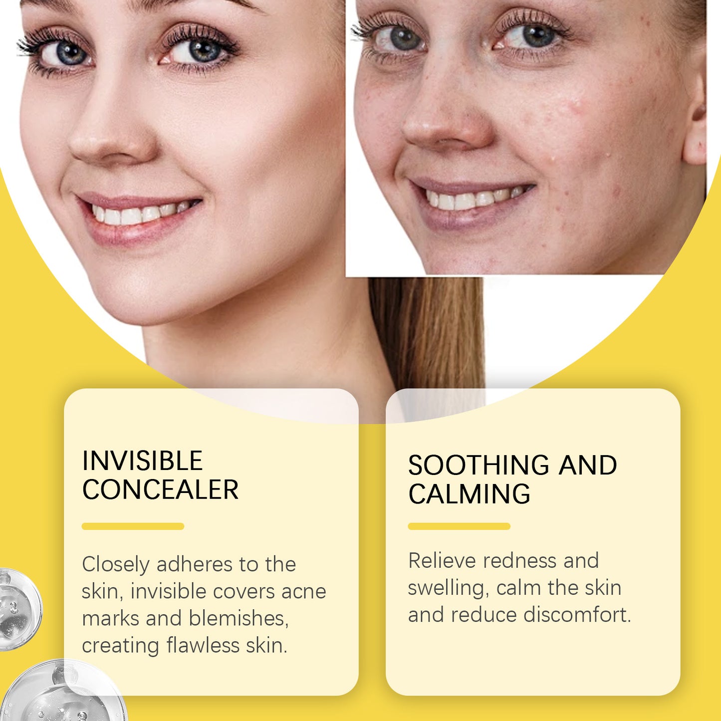 Jaysuing Star Acne Patch Clear Acne Skin Care Facial Cover Acne Invisible Acne Patch